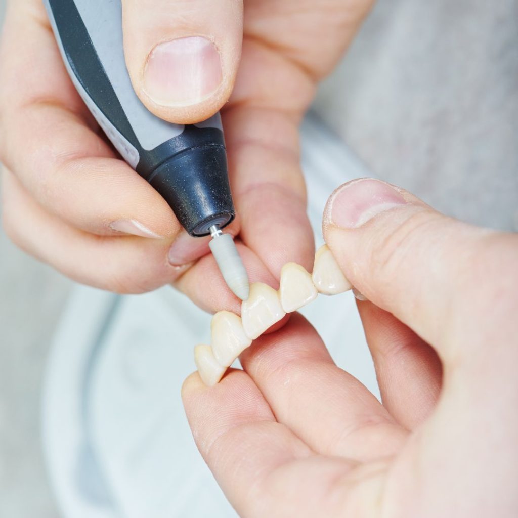Dentiera a Vicenza