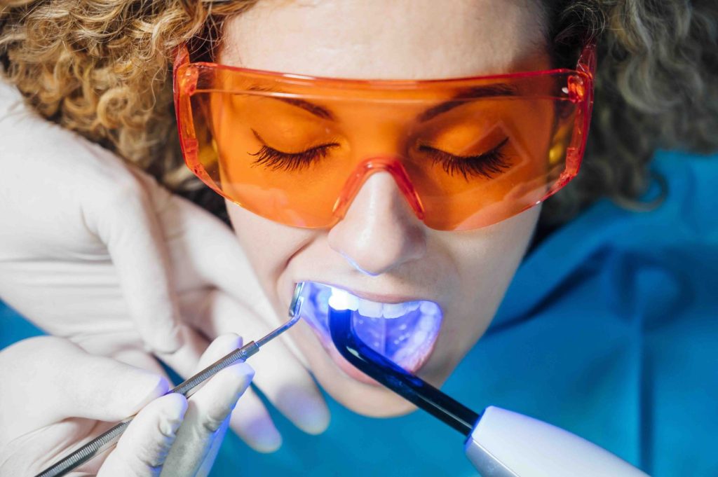 Sbiancamento denti
